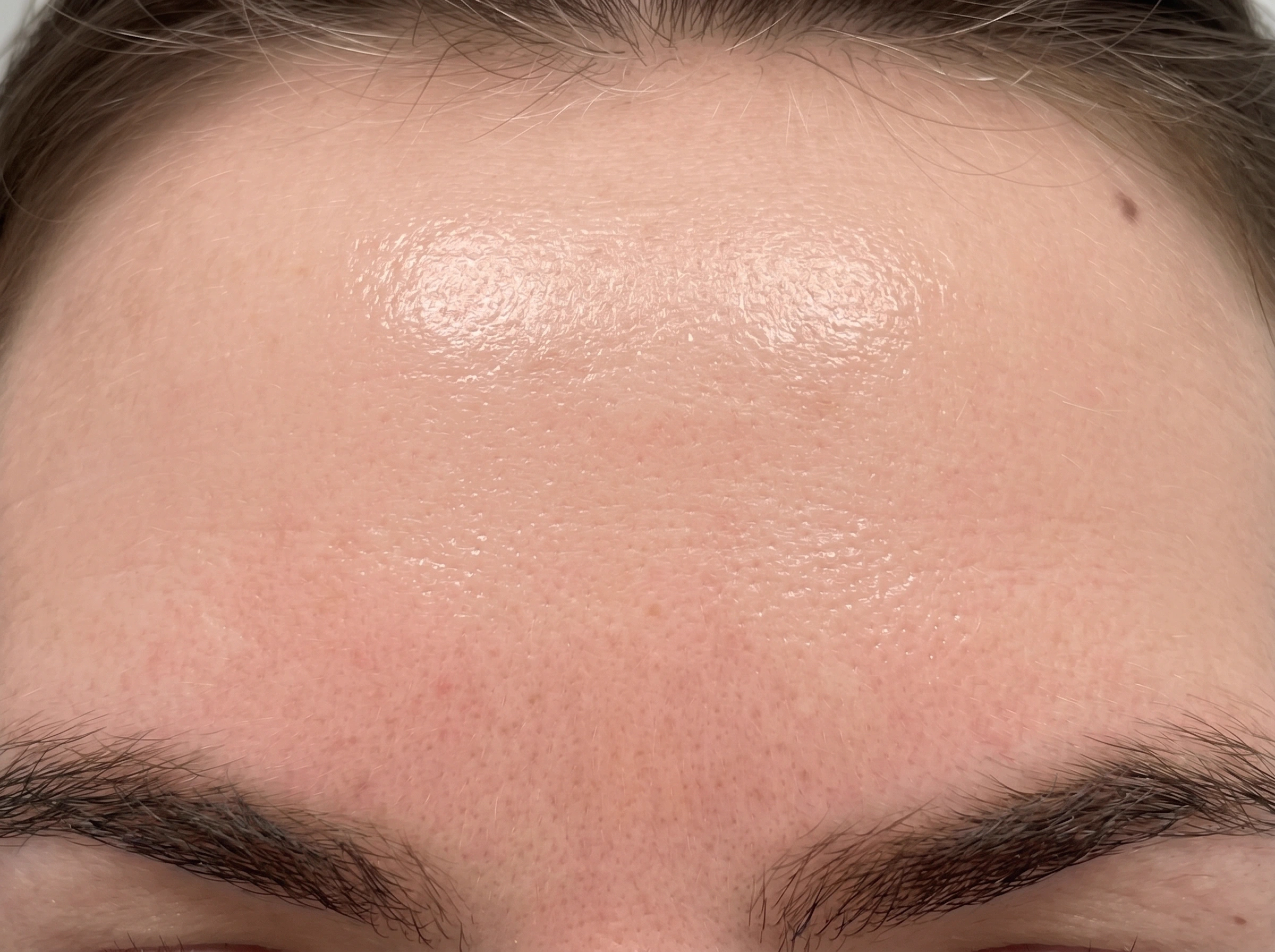 BIO-COLLAGEN + PDRN PRO MASK — after de-tan
