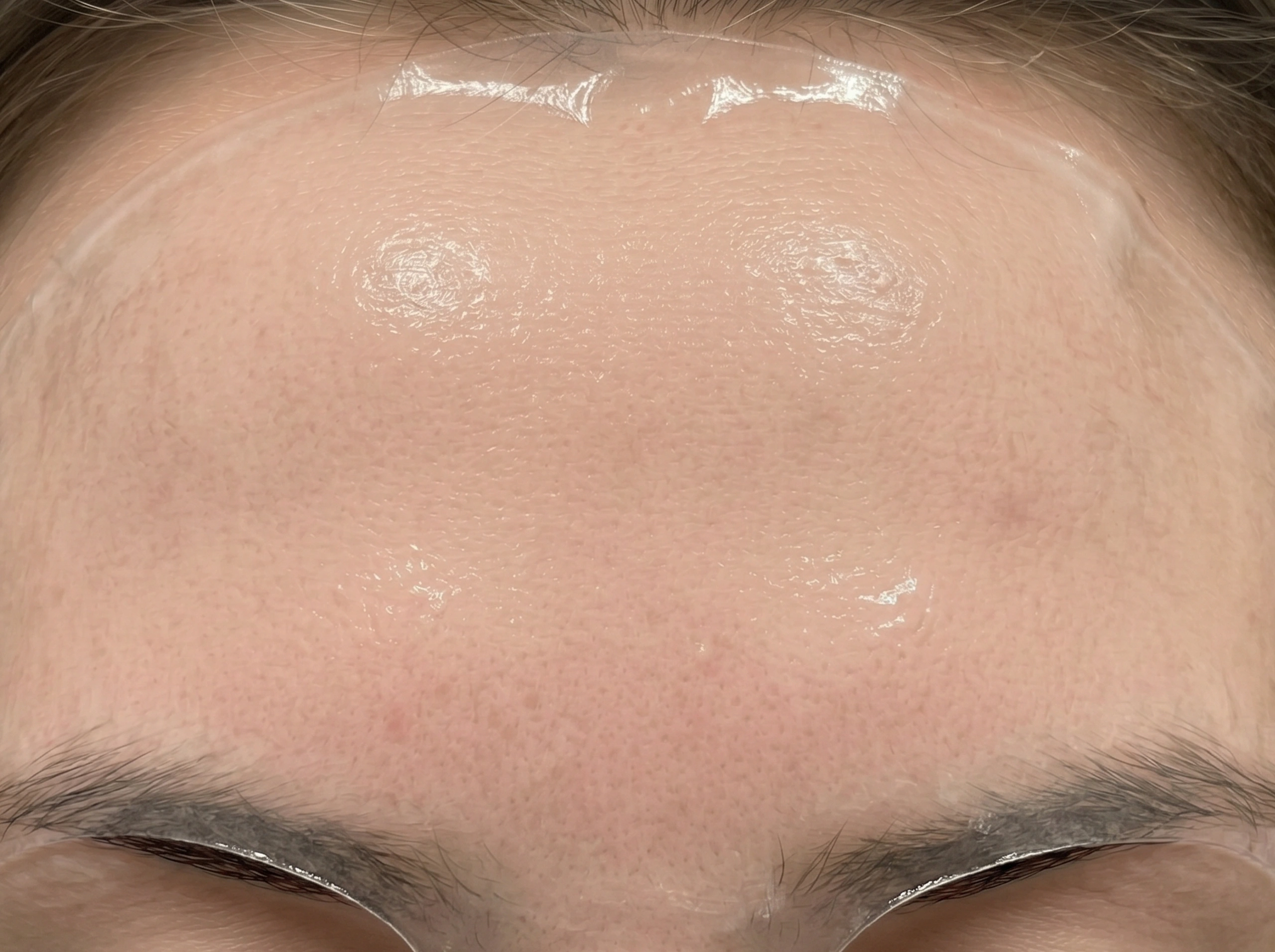 BIO-COLLAGEN + PDRN PRO MASK — before de-tan